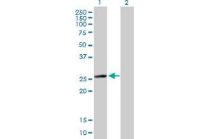 Western Blot analysis of MYL6B expression in transfected 293T cell line by MYL6B MaxPab polyclonal antibody.
