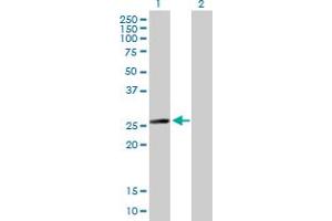 Western Blot analysis of MYL6B expression in transfected 293T cell line by MYL6B MaxPab polyclonal antibody. (MYL6B anticorps  (AA 1-208))