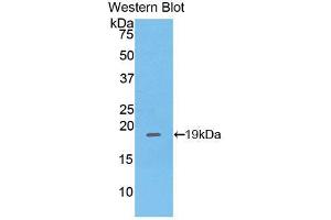 Western blot analysis of the recombinant protein. (PHLDA2 anticorps  (AA 9-140))
