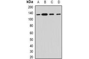 Western blot analysis of Myosin Ic expression in HT29 (A), SKOV3 (B), mouse lung (C), rat heart (D) whole cell lysates. (Myosin IC anticorps)