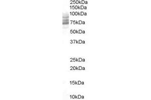 Western Blotting (WB) image for anti-Cytochrome B-561 (CYB561) (N-Term) antibody (ABIN2777099) (CYB561 anticorps  (N-Term))