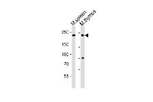 Western blot analysis of lysates from mouse spleen, mouse thymus tissue lysate (from left to right), using Zcchc11 Antibody (C-term) (ABIN6242704 and ABIN6577657).