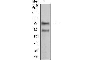 Western blot analysis using NCAM1 mouse mAb against NIH/3T3 (1) cell lysate. (CD56 anticorps  (AA 568-708))