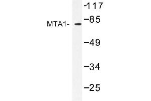 Image no. 1 for anti-Metastasis Associated 1 (MTA1) antibody (ABIN272222) (MTA1 anticorps)