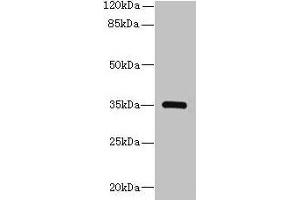 Western blot All lanes: STX19 antibody at 2 μg/mL + K562 whole cell lysate Secondary Goat polyclonal to rabbit IgG at 1/10000 dilution Predicted band size: 35 kDa Observed band size: 35 kDa (Syntaxin 19 anticorps  (AA 1-140))