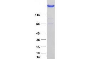 Validation with Western Blot