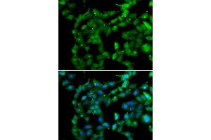 Immunofluorescence analysis of U20S cell using PRKAB2 antibody. (PRKAB2 anticorps)