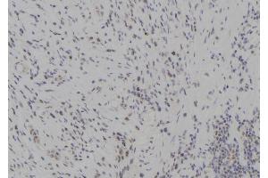 ABIN6265480 and ABIN6277285 at 1/100 staining Human gastric tissue by IHC-P.