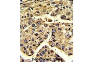 Immunohistochemistry (IHC) image for anti-Eukaryotic Translation Initiation Factor 3 Subunit H (EIF3H) antibody (ABIN3002723)