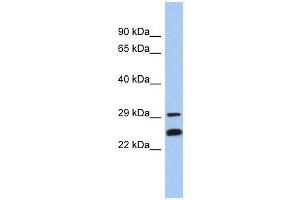 NSMCE2 antibody used at 1 ug/ml to detect target protein. (NSMCE2 anticorps)