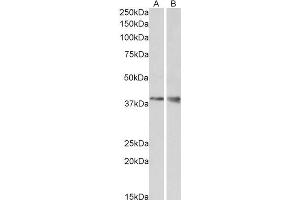 ABIN571005 (1µg/ml) staining of Mouse Kidney (A) and Brain (B) lysate (35µg protein in RIPA buffer).