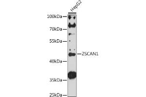 Western blot analysis of extracts of HepG2 cells, using ZSC antibody (ABIN7271441) at 1:1000 dilution. (ZSCAN1 anticorps  (AA 300-400))