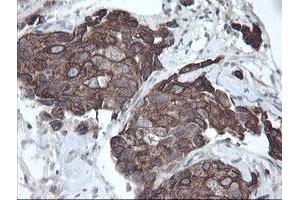 Image no. 2 for anti-Diphthamide Biosynthesis Protein 2 (DPH2) antibody (ABIN1497892)