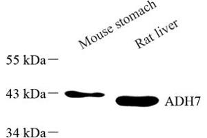 Western blot analysis of ADH7 (ABIN7072995) at dilution of 1: 500