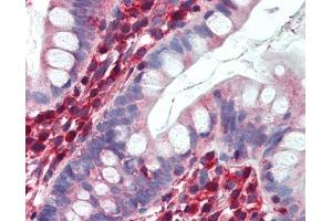 LDHB antibody was used for immunohistochemistry at a concentration of 4-8 ug/ml.