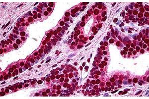 Human Prostate: Formalin-Fixed, Paraffin-Embedded (FFPE) (MEF2A anticorps  (AA 71-170))