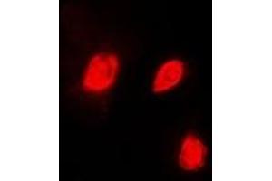 Immunofluorescent analysis of EID1 staining in HeLa cells. (EID1 anticorps)