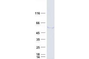 Validation with Western Blot