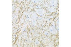Immunohistochemistry of paraffin-embedded mouse spinal cord using CNP antibody. (Cnpase anticorps  (AA 152-421))