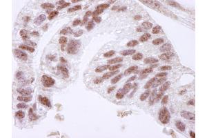 Immunohistochemistry (IHC) image for anti-CCCTC-Binding Factor (Zinc Finger Protein) (CTCF) (AA 650-700) antibody (ABIN7448500)