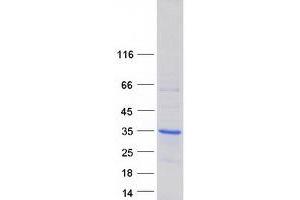 Validation with Western Blot