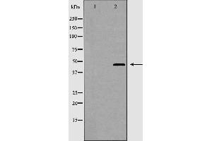 Western blot analysis of CRFR2 expression in K562 cells. (CRHR2 anticorps  (Internal Region))
