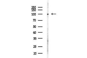 anti-Mannosyl (Alpha-1,6-)-Glycoprotein beta-1,6-N-Acetyl-Glucosaminyltransferase (MGAT5) antibody