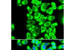 Immunofluorescence analysis of MCF-7 cells using RPS3A Polyclonal Antibody (RPS3A anticorps)