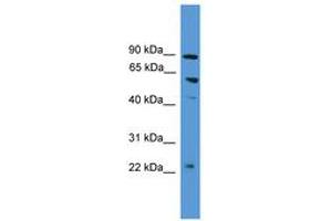 Image no. 1 for anti-PDZ Domain Containing 1 (PDZK1) (AA 80-129) antibody (ABIN6745417)