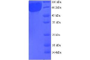AGALB (AA 21-443) protein (His tag)