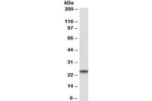 Western blot testing of human testis lysate with RAN antibody at 1ug/ml. (RAN anticorps)