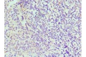 Immunohistochemistry of paraffin-embedded human tonsil tissue using ABIN7156622 at dilution of 1:100 (IRF4 anticorps  (AA 180-451))