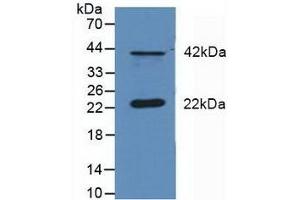 Detection of DUSP6 in Mouse Cerebellum Tissue using Polyclonal Antibody to Dual Specificity Phosphatase 6 (DUSP6) (DUSP6 anticorps  (AA 1-300))