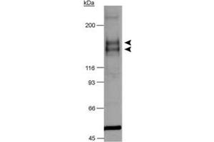 Western blot analysis of Flt1 in chimeric CSF-1R/VEGFR-2 detection in transfected lysates using Flt1 polyclonal antibody . (FLT1 anticorps  (AA 800-900))