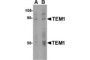 Western Blotting (WB) image for anti-CD248 Molecule, Endosialin (CD248) (C-Term) antibody (ABIN1030727) (CD248 anticorps  (C-Term))