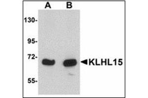 Western blot analysis of KLHL15 in HeLa cell lysate with KLHL15 antibody at (A) 1 and (B) 2 µg/ml. (KLHL15 anticorps  (C-Term))