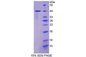 SDS-PAGE (SDS) image for Keratin 7 (KRT7) (AA 91-394) protein (His tag) (ABIN1080157)