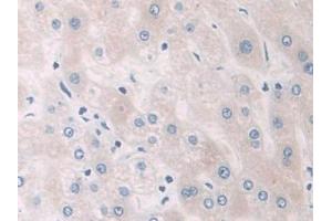 Detection of PYGB in Human Liver Tissue using Polyclonal Antibody to Glycogen Phosphorylase, Brain (PYGB)
