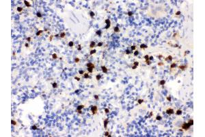 Anti- S100A9 Picoband antibody, IHC(P) IHC(P): Rat Spleen Tissue (S100A9 anticorps  (AA 2-113))
