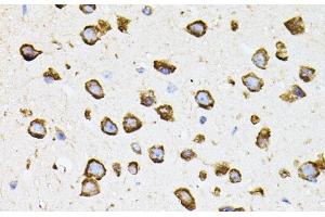 Immunohistochemistry of paraffin-embedded Mouse brain using IRF1 Polyclonal Antibody