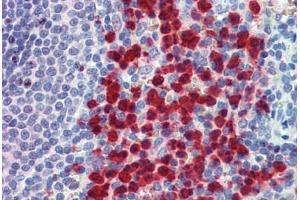 Human Spleen: Formalin-Fixed, Paraffin-Embedded (FFPE) (Cell Adhesion Molecule 4 anticorps  (AA 370-384))