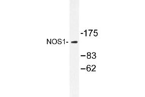 Image no. 1 for anti-Nitric Oxide Synthase 1, Neuronal (NOS1) antibody (ABIN272121) (NOS1 anticorps)