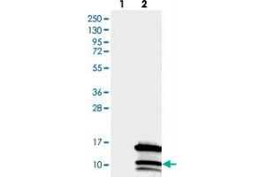 Western blot analysis of Lane 1: Negative control (vector only transfected HEK293T lysate), Lane 2: Over-expression Lysate (Co-expressed with a C-terminal myc-DDK tag (~3. (CCDC23 anticorps)