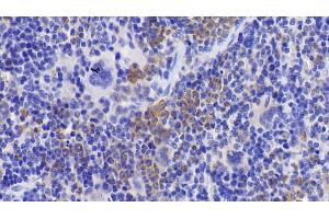 Detection of CDK2 in Mouse Spleen Tissue using Polyclonal Antibody to Cyclin Dependent Kinase 2 (CDK2)
