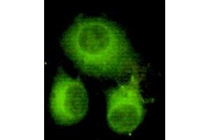 Immunocytochemistry of HeLa cells using anti-ATP-Citrate Lyase (C-terminus) mouse mAb diluted 1:150.