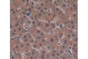 IHC-P analysis of liver tissue, with DAB staining. (ADAMTS13 anticorps  (AA 682-859))