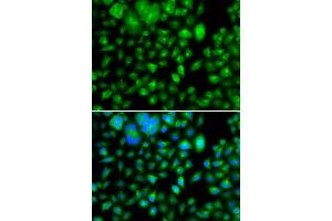 Immunofluorescence analysis of A549 cell using METTL7B antibody. (METTL7B anticorps)