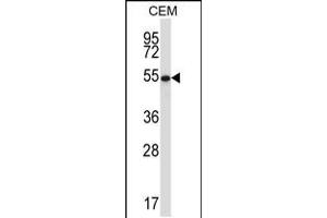 Western blot analysis in CEM cell line lysates (35ug/lane). (GABPA anticorps  (AA 283-311))