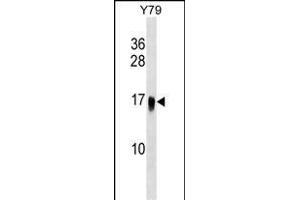 UBE2G1 Antibody (C-term) (ABIN1536693 and ABIN2848805) western blot analysis in Y79 cell line lysates (35 μg/lane).
