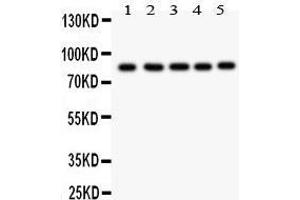 Anti- FOXM1 antibody, Western blotting All lanes: Anti FOXM1  at 0.